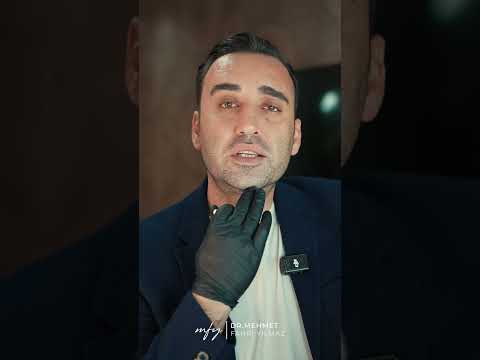 Mehmet Fahri Yılmaz | Çene Uç Dolgu