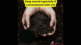 Nurse Charlene Teloka explaining which wounds are Tetanus prone