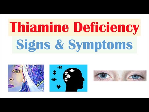 Thiamine (Vit B1) Deficiency Signs & Symptoms (& Why They Occur)