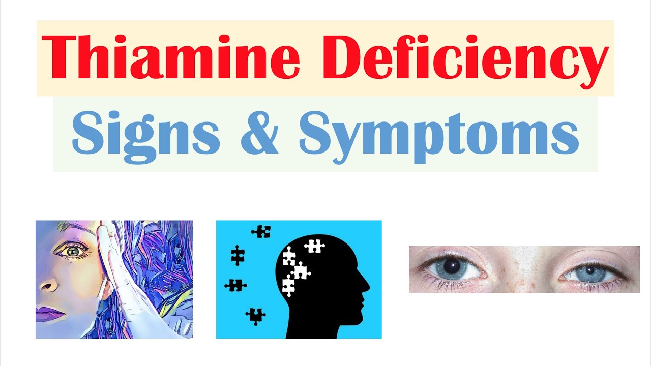Thiamine (Vit B1) Deficiency Signs & Symptoms (& Why They Occur)