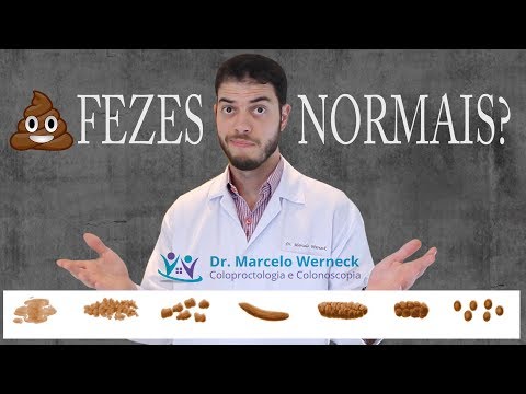 , title : 'Fezes NORMAIS?!?! | Dr. Marcelo Werneck'