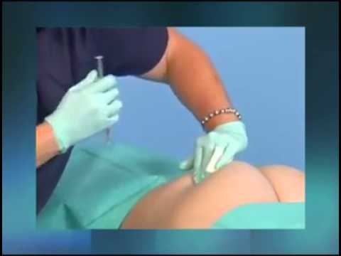 ตัวแทนประเทศจีนสำหรับโรคสะเก็ดเงิน Neurodermatitis ยาแก้คัน