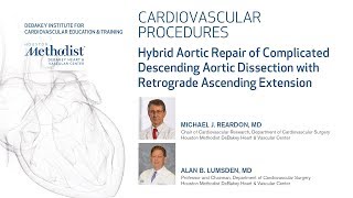 Download Lagu Hybrid Aortic Repair (Michael J. Reardon, MD and Alan B. Lumsden, MD) Thumbnail