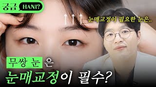 무쌍은 눈매교정이 무조건 필수인건가요?🤔ㅣ진실이 궁금하니?