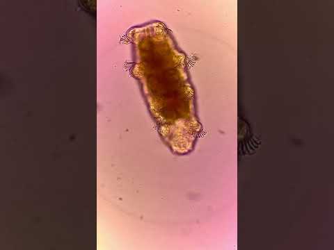 I found a new WATERBEAR (tardigrade)!