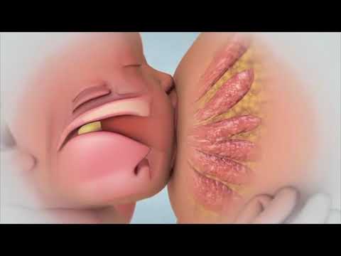 Sinh xong làm sao có sữa ngay -Tư vấn sữa mẹ về nhiều 094.740.1359