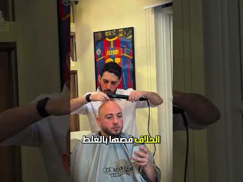 شعرة وحدة كانت تحميه من الصلع! 😱😂