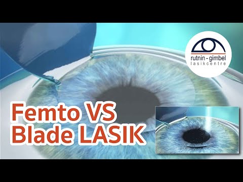 Femto VS Blade LASIK / Rutnin-Gimbel LASIK Centre