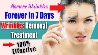 How To Get Rid Of Wrinkles Above Your Lips In 7 Days
