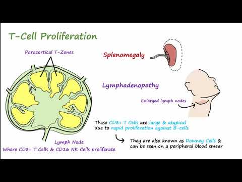Infectious Mononucleosis or “Mono”