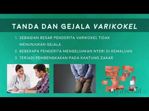 Potensi. pengobatan impotensi Bagaimana untuk menyingkirkan impotensi