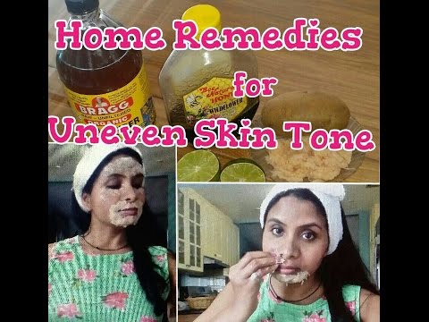 Home remedies for uneven skin tone/How to alleviate Hyper Pigmentation |GeetaKAgarwal