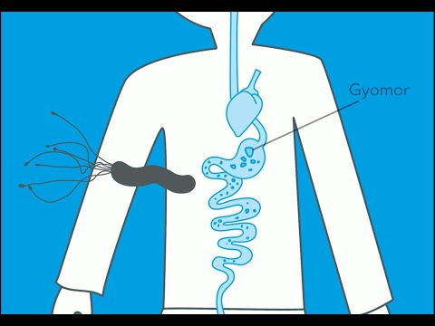 Elveszíti makacs has kövér nőstény Szuper egyszerű módja a gyors fogyásnak