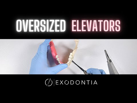 Another Approach To Elevating Teeth | OnlineExodontia.com