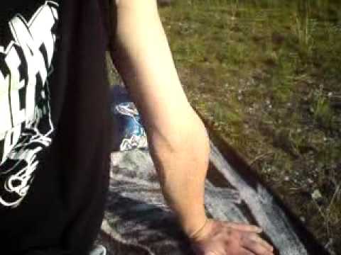 Ficus Tinktur Osteochondrose Osteochondrose Malyshev YouTube