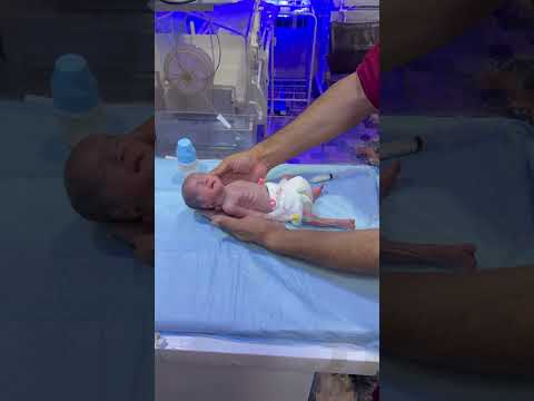 NICU Baby Physiotherapy After Feeding | Premature Baby Care #amnioticfluid #baby
