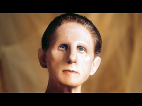 What The Hell Happened To René Auberjonois?