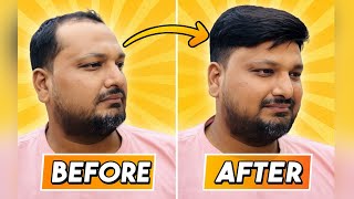 "Best Clip System Hair Patch Transformation | Natural Look & Easy to Use | Rizy Hair Solution 💇‍♂️✨"