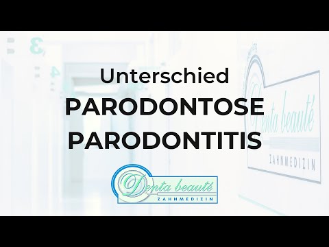 Was ist der Unterschied zwischen Parodontose und Parodontitis