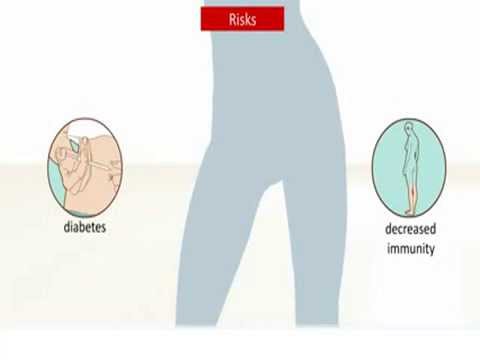 Möglich-ob eine Abkochung von Hagebutten bei Diabetes verwenden Behandlung des diabetischen Makulaödems