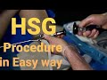 HSG | HYSTEROSALPINGOGRAPHY | RADIOLOGY PROCEDURE | ASIF MALIK |