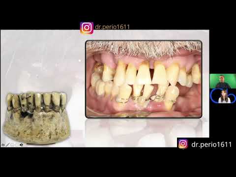 ¿Qué es la PERIODONCIA? Antecedentes