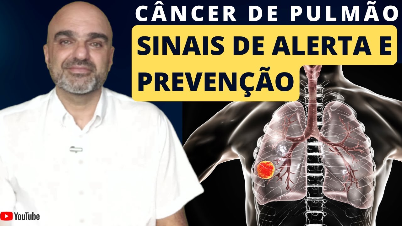 Sinais de Alerta para o CÂNCER DE PULMÃO