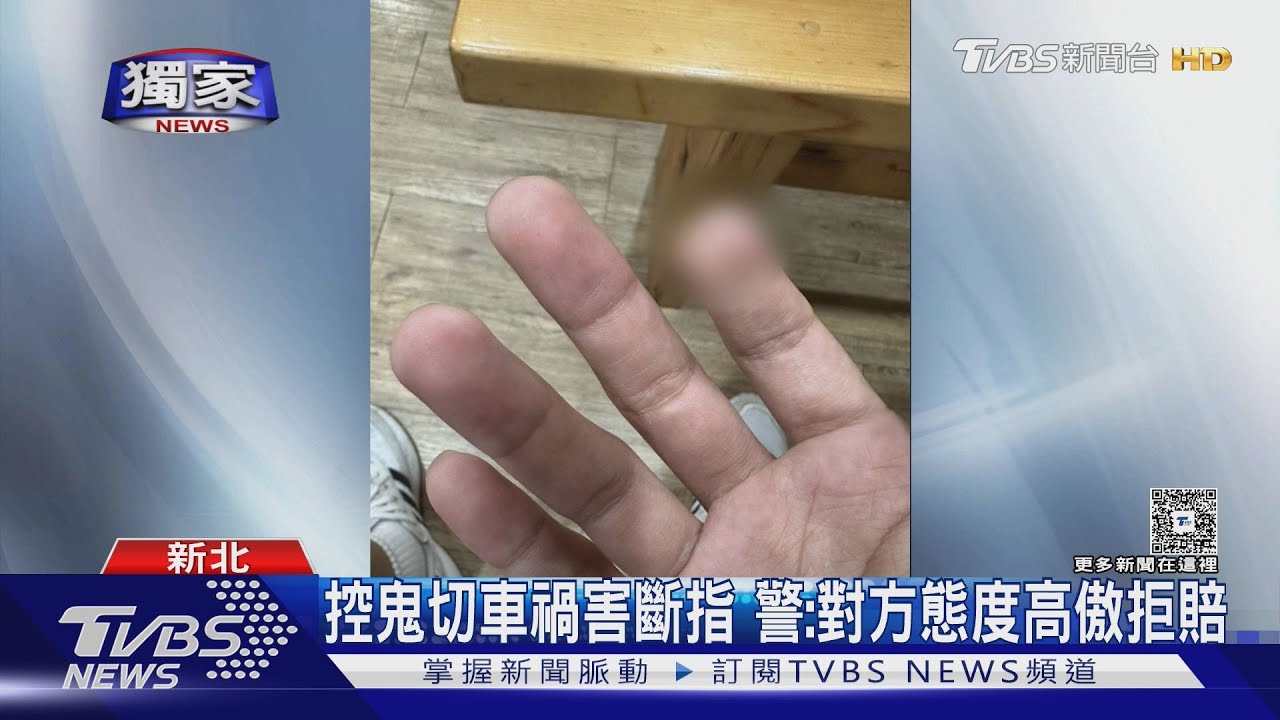 撞警害「斷指」!騎士遭求償200萬難接受 警:他態度高傲拒賠