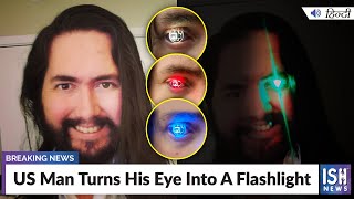 US Man Turns His Eye Into A Flashlight