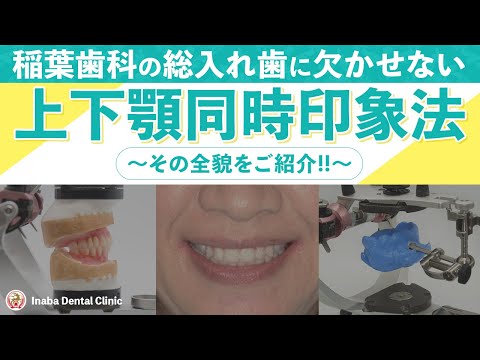 稲葉歯科の総入れ歯に欠かせない上下顎同時印象法〜その全貌をご紹介‼︎〜
