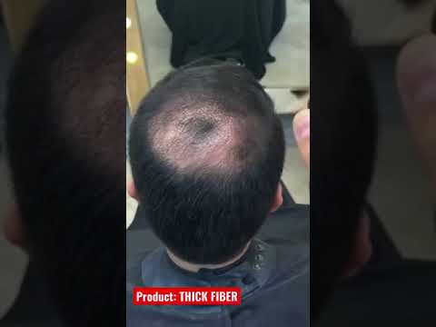 Thinning Hair Concealer ! Hair Transformation