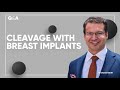 How Do You Make Cleavage With Breast Implants Q A With Dr Gerth