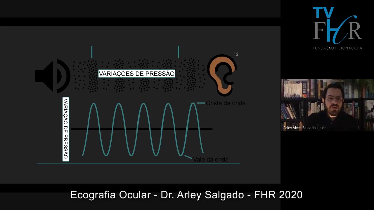 Arley Alves Salgado Junior-0