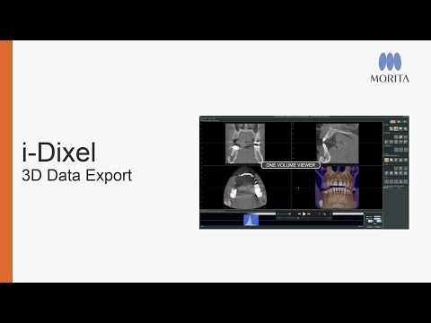 How to export CT data and DICOM series from i-Dixel