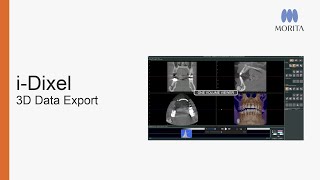 Whether for archiving or sharing with other practitioners, this tutorial will guide you through how to export CT data from i-Dixel along with…