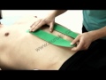 Tejpování přímého břišního svalu (musculus rectus abdominis) - Obrázek