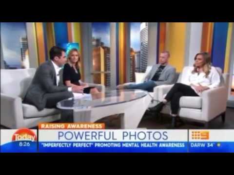 Imperfectly Perfect Campaign Founder Glenn Marsden & Actress Marny Kennedy on The Today Show
