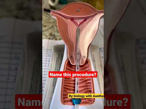 #shorts #short #shortsvideo #viralshorts #neet #aiims #biology #physicswallah #iud  #mbbs #doctor🥀💊