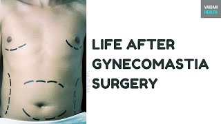 Life after Gynecomastia Surgery