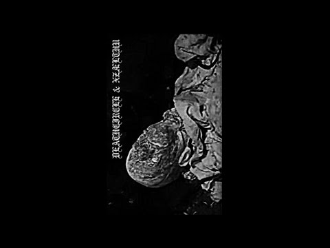 Deathcircle (Bosnia and Herzegovina) / Xzælthu (Unknown) - Split 2021