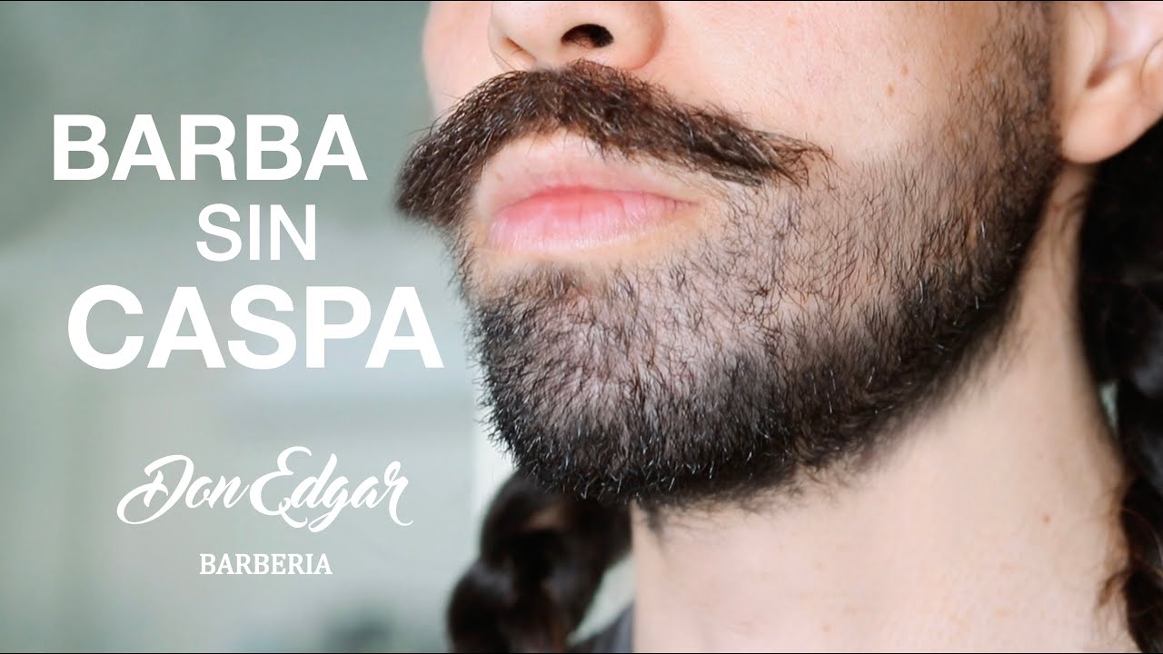 Watch ¿CÓMO QUITAR LA CASPA DE LA BARBA - DON EDGAR BARBERÍA Now ¿CÓMO QUITAR LA CASPA DE LA BARBA - DON EDGAR BARBERÍA