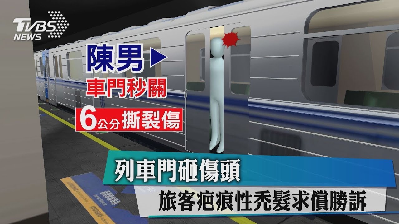 列車門夾傷頭 旅客疤痕性禿髮求償勝訴