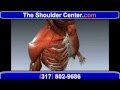 Shoulder Pain - All About Tendonitis, Frozen ...