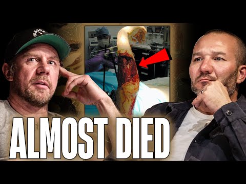 The Real Story on How Delta Force Operator Tyler Grey Almost Lost His Arm in Combat