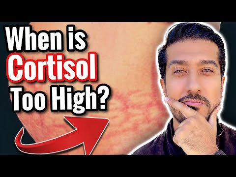 5 Signs of High Cortisol to NOT IGNORE | What Lowers Cortisol?