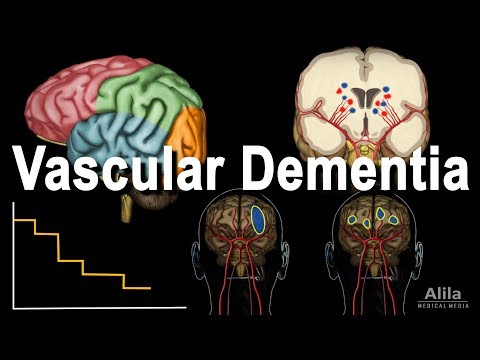 Vascular Dementia Pathology, Animation