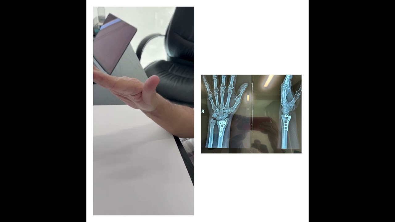 Diego Gomez Orozco-16