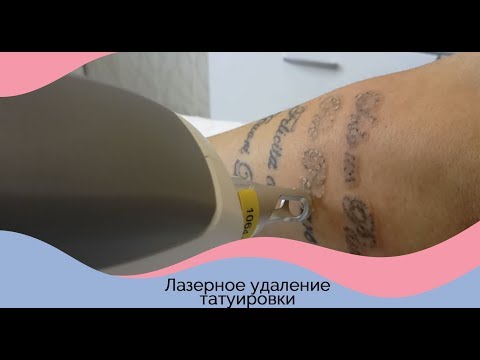 Почему на руках появляются пигментные пятна у мужчин Йошкар ола детский сад 39 веснушка отзывы