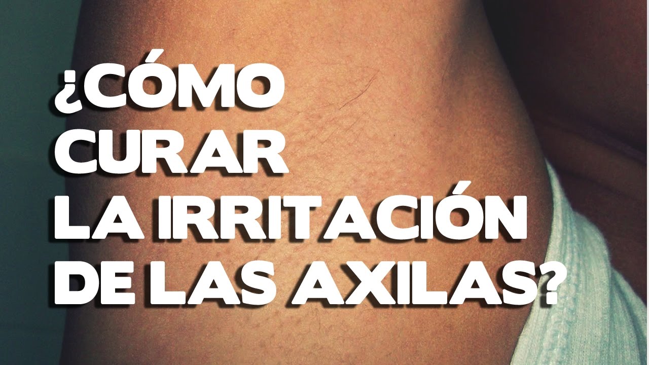 Como cuarar la irritacion de las axilas, causas y remedios para aliviar la irritacion
