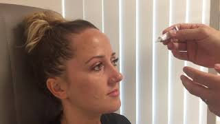 Augensalbe verabreichen